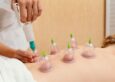 Cupping Therapy in Nelson