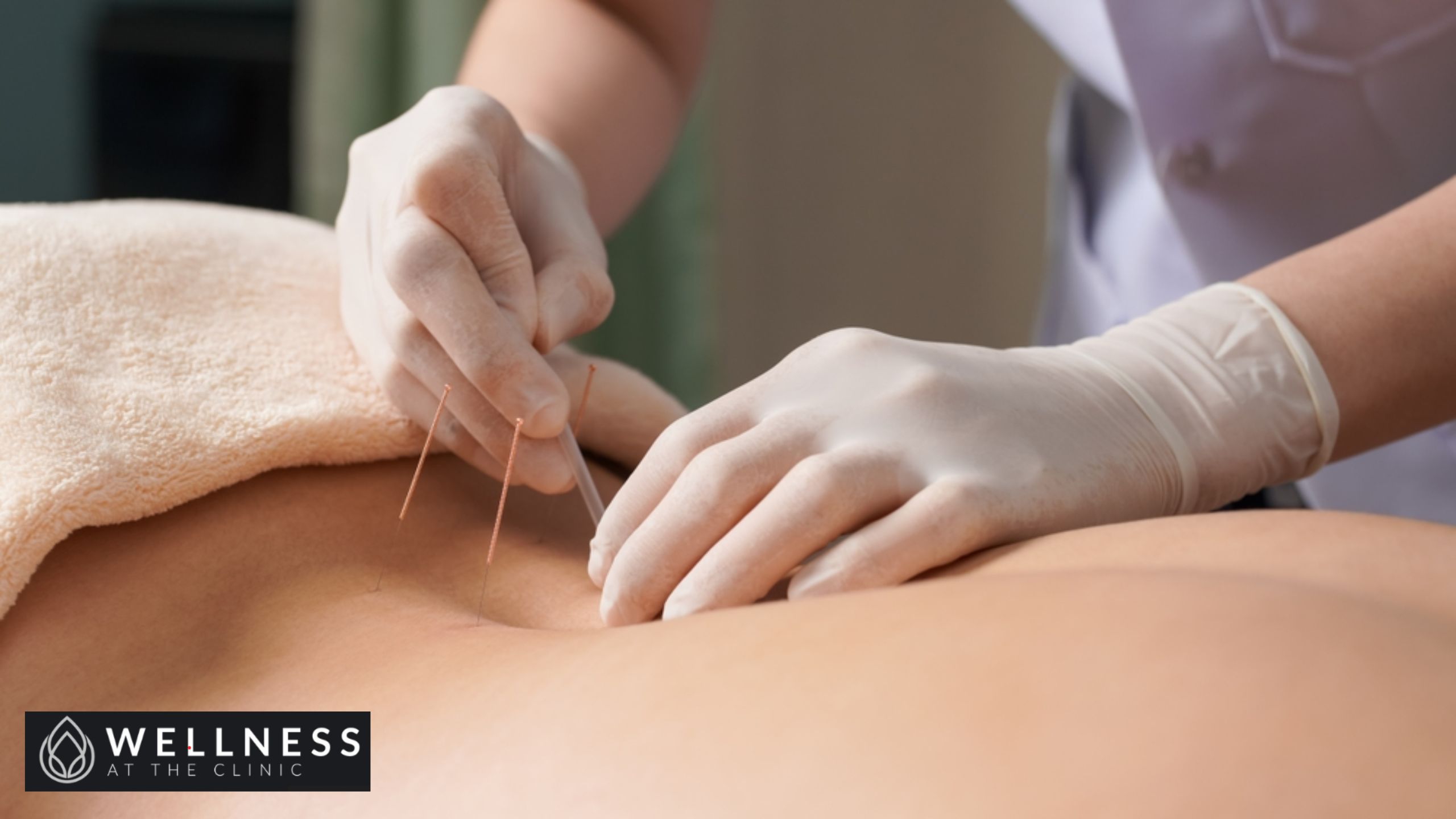 Acupuncture Clinic in Nelson