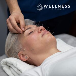 Acupuncturist Lancashire