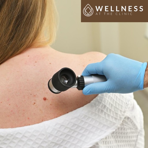 Dermatology Clinic in Nelson